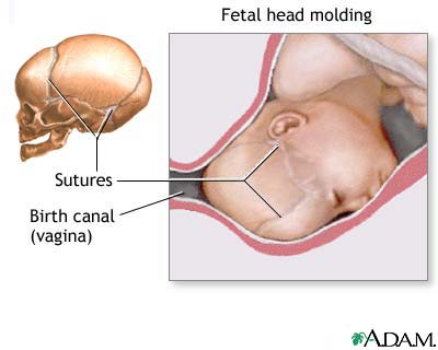 Newborn molding 2.jpg